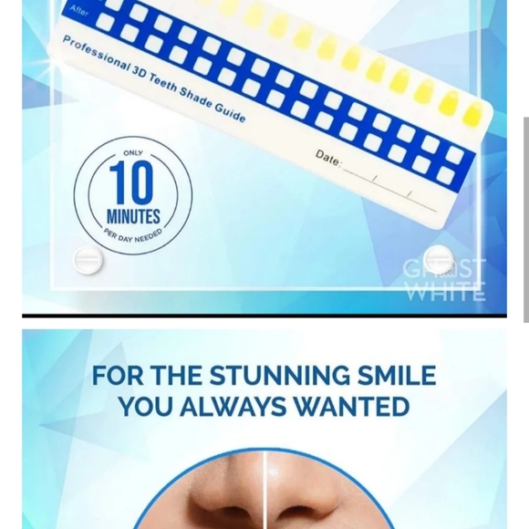 Teeth Whitening Kit LED Light - Picture 2 of 3